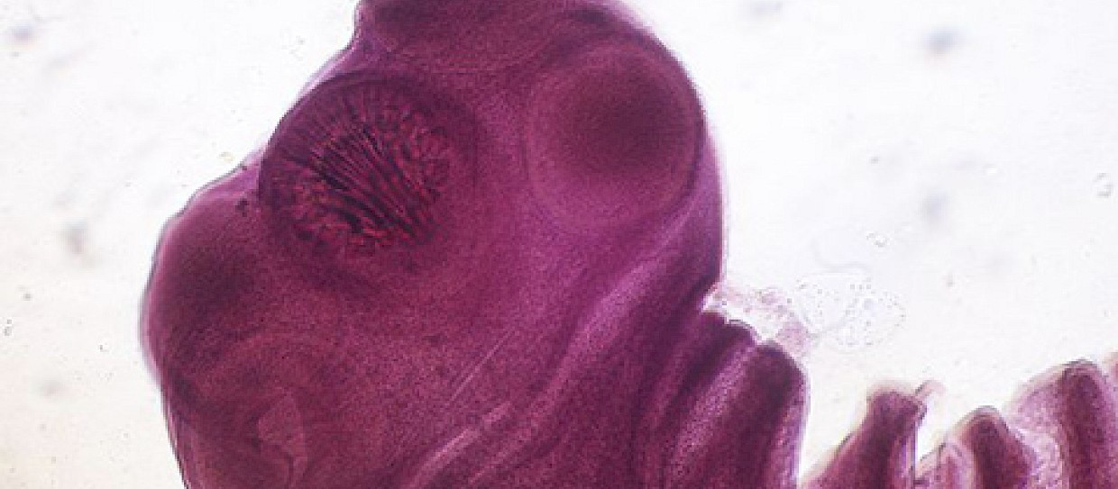 Taenia solium (tenia o verme solitario) e cisticercosi