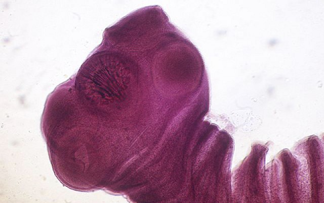 Taenia solium (tenia o verme solitario) e cisticercosi