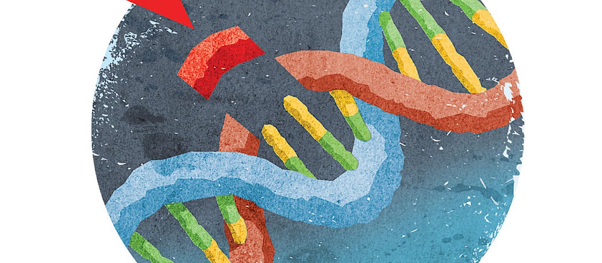 Trattare la leucemia con cellule immunitarie modificate geneticamente?