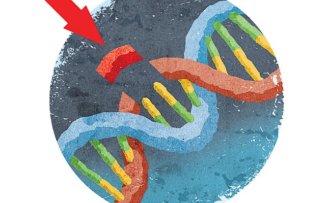 Trattare la leucemia con cellule immunitarie modificate geneticamente?