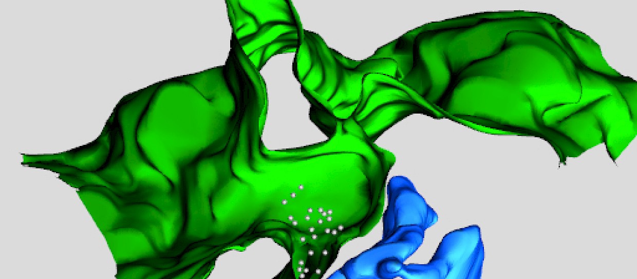 Ricerca italiana scopre come cellula “rottama” recettore implicato nei tumori