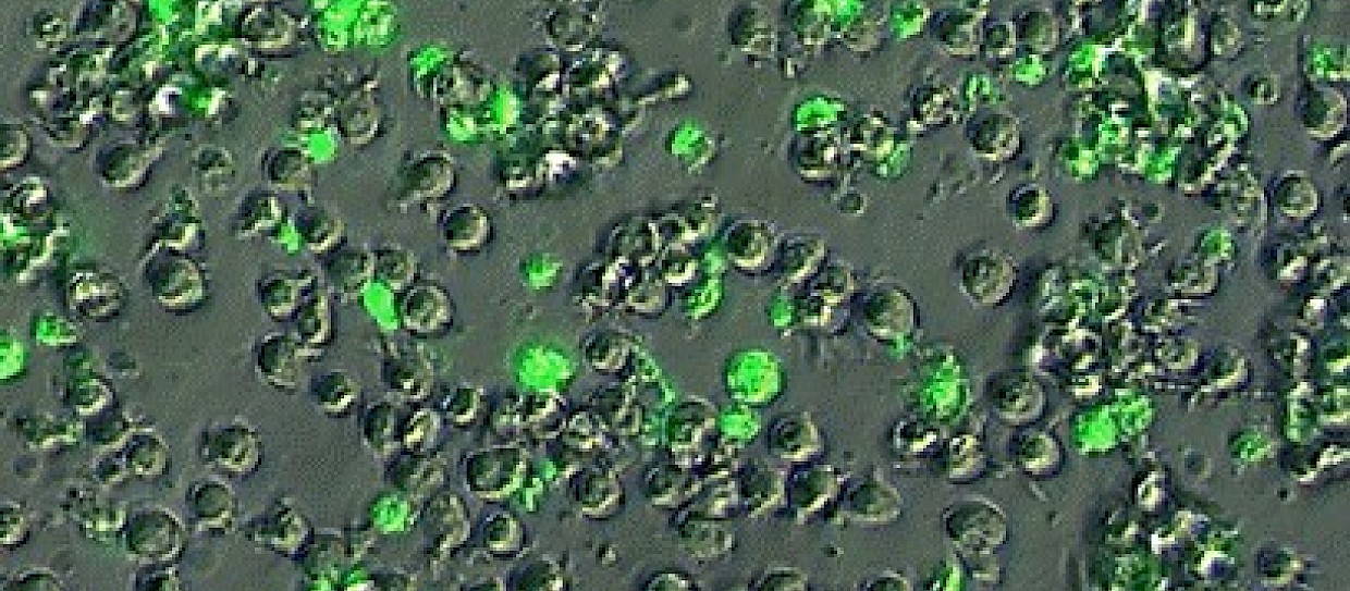 Polifenoli contro il cancro? Un vantaggio da approfondire