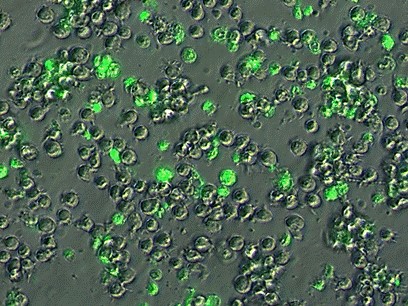 Immagine - Cellule derivate da Leucemia linfocitaria cronica trattate con quercetina e con il farmaco apoptogenico ABT-737. In verde chiaro, le cellule tumorali morte