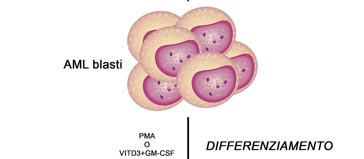Identificati nuovi marcatori molecolari della leucemia mieloide acuta (LMA)