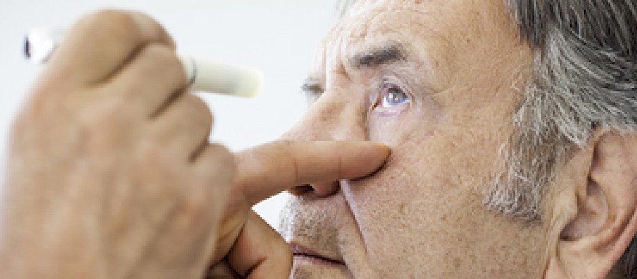 Scoperto link decisivo tra l'Alzheimer e le patologie agli occhi