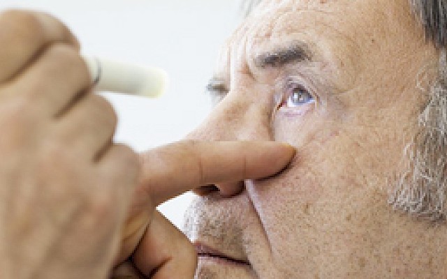 Scoperto link decisivo tra l'Alzheimer e le patologie agli occhi