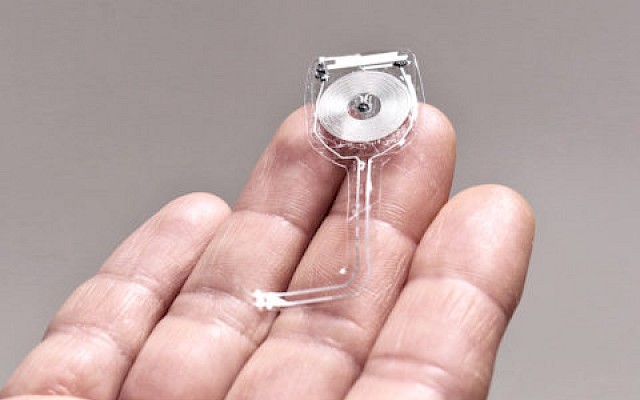 Realizzato primo impianto elettronico che si dissolve nel corpo