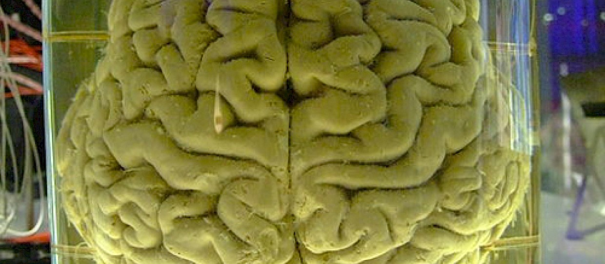 "Liberare" il cervello umano alterando gli stati di integrazione dinamica e segregazione