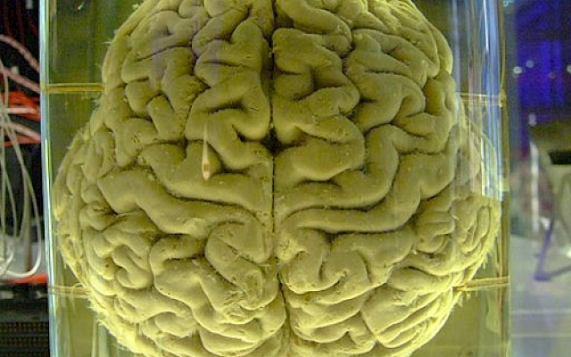 "Liberare" il cervello umano alterando gli stati di integrazione dinamica e segregazione